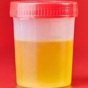 تصویر یورین باتل 60 میل (کارتنی) 