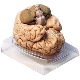 تصویر مولاژ مغز انسان مدل 2Parts کد A2 