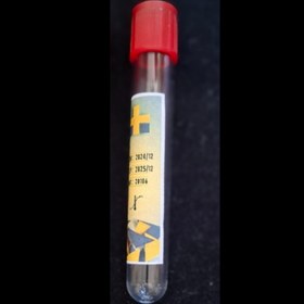 تصویر لوله پلین PRF 