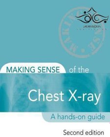 تصویر Making Sense of the Chest X-ray: A hands-on guide, 2nd Edition2013 ساختن حس اشعه ایکس قفسه سینه: یک راهنمای عملی Making Sense of the Chest X-ray: A hands-on guide, 2nd Edition2013 ساختن حس اشعه ایکس قفسه سینه: یک راهنمای عملی