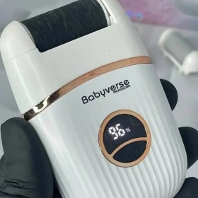 تصویر سنگ پا مارک بابی ورس 