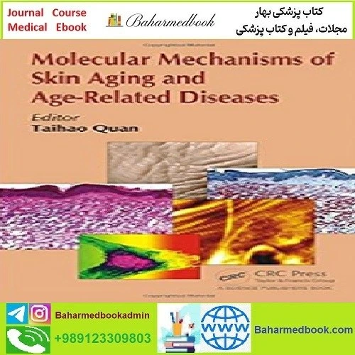 خرید و قیمت Molecular Mechanisms of Skin Aging and Age Related Diseases ...