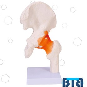 تصویر مولاژ ران 