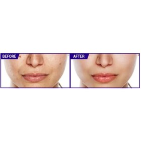 تصویر کانسیلر جی کت 