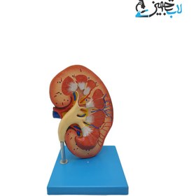 تصویر مولاژ کلیه ا 