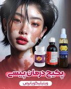 تصویر درمان برص،پیسی،وتیلیگو 