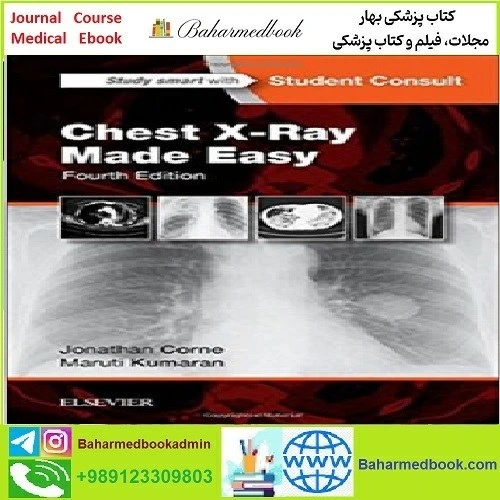 خرید و قیمت Chest X Ray Made Easy TRUE PDF price 1€ | ترب