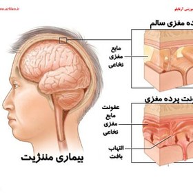 تصویر جزوه آنالیز CSF 