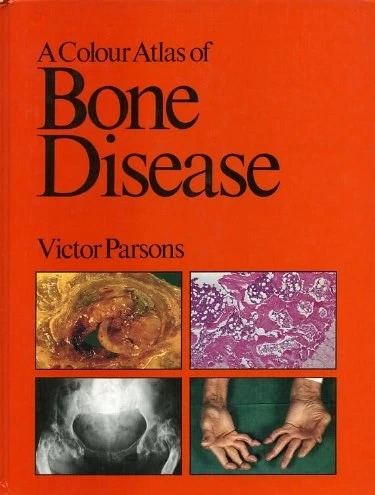 خرید و قیمت دانلود کتاب A Colour Atlas of Bone Disease (Wolfe Medical ...