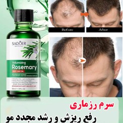 تصویر روغن رشد مو رزماری 