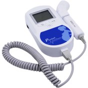 تصویر دستگاه شنود صدای قلب جنین (داپلر جنین) مدل Doppler Fetal Contec درجه یک و کیفیت عالی و قیمت مناسب 