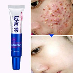 تصویر پماد ضد جوش فوری 