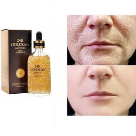 تصویر سرم طلا گلد زن Gold Serum