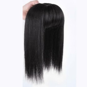 تصویر پروتز چتری پرحجم 