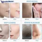 تصویر هیدروفیشیال 8کاره نیوفیس موتور سنگین مجهز به مزوگان پیشرفته 8-function facial machine with heavy-duty motor and mesotherapy