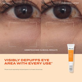 تصویر کرم دور چشم مورد مدل Targeted Eye Depuffer حجم ۱۵ میلی لیتر 