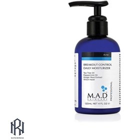 تصویر پیلینگ شیمیایی اسیدتراپی 