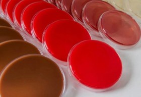 تصویر بلاد آگار پلیت ۸ سه خانه 