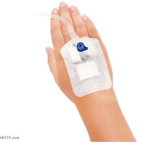 تصویر چسب آنژیوکت فاقد مواد حساسیت زا