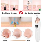 تصویر دستگاه میکرودرم خانگی ۵ کاره میکروپلاس ساخت کره 