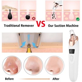 تصویر میکرودرم پاک سازی و مراقبت از پوست مدل Full 