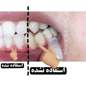 تصویر قطره سفید کننده دندان پس کرایه 