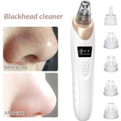 تصویر میکرودرم ابریژن ۵ کاره مدل HY9 اصل Microderm abrasion 5 in 1