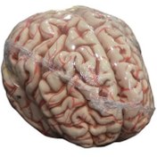 تصویر مولاژ مغز انسان 