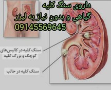 تصویر داروی گیاهی سنگ کلیه موثر برای دفع سنگ کلیه 