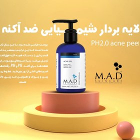 تصویر پیلینگ شیمیایی اسیدتراپی آکنه ام ای دی M.A.D 