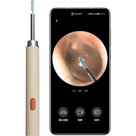 تصویر گوش پاک کن هوشمند شیائومی مدل ZD-CEB-6 