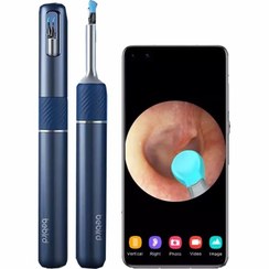 تصویر تميزکننده گوش دوربین دار شیائومی مدل Bebird Note 5 Ear Wax Removal with Camera Bebird Note 5 Ear Wax Removal with Camera