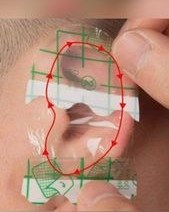 تصویر چسب گوش 