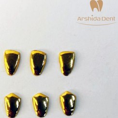 تصویر دندان روکش طلا 