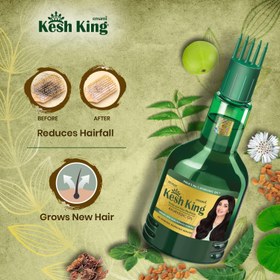 تصویر روغن رویش مجدد ۲۱گیاه کشکینگ Kesh king oil