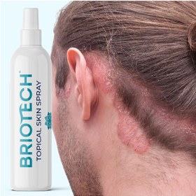 تصویر اسپری اسید هیپوکلروس بریوتک برای صورت و بدن - تسکین‌دهنده تحریکات، کاهش قرمزی، پوست خشک و خارش ورزشی برند briotech Briotech hypochlorous acid spray topical skin face & body mist support irritations soothe redness dry skin & scalp athletic itch