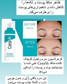 تصویر سرم رتینول بازسازی کننده پوست سراوی CeraVe حجم 30 میل 