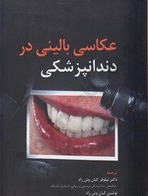 تصویر افزایش ابعاد استخوان در دندانپزشکی ایمپلنت 2019 