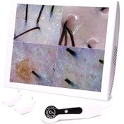 تصویر آنالیزور پوست و مو ۱۰ اینچ 