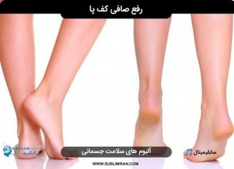 تصویر درمان صافی کف پا 
