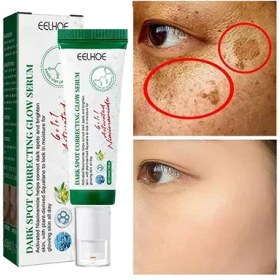 تصویر سرم درمان جوش و آکنه ایلهو EELHOE اورجینال EELHOE a.a serum treatment