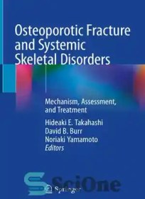 تصویر دانلود کتاب Osteoporotic Fracture and Systemic Skeletal Disorders: Mechanism, Assessment, and Treatment - شکستگی استئوپروز و اختلالات اسکلتی سیستمیک: مکانیسم، ارزیابی و درمان 