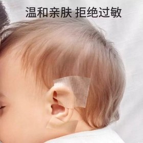 تصویر چسب اصلاح فرم گوش Ear shaping glue