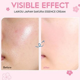 تصویر کرم آبرسان ساکورا شکوفه گیلاس ژاپنی روشن‌کننده،مغذی پوست لایکو LAIKOU Japan Sakura Essence Cream