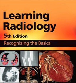 تصویر Learning Radiology: Recognizing the Basics 5th Edition William Herring, B0BVW5BD8N, 0323878172, 0323878199, 9780323878173, 9780323878197, 978-0323878173, 978-0323878197
