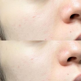 تصویر سرم کوچک کننده منافذ سوپرماچا سام بای می SOME BY MI Super Matcha Pore Tightening Serum