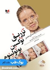 تصویر راهنمای مصور تزریق توکسین بوتولینوم 