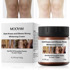 تصویر کرم سفید کننده زانو و آرنج مویام 