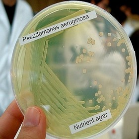 تصویر سودوموناس آئرژینوزا Pseudomonas aeruginosa Pseudomonas aeruginosa