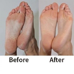 تصویر سنگ پا شارژی 